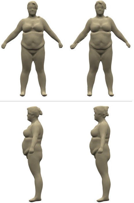 Before and after weight loss results