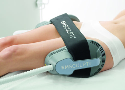 Photo of a woman getting Emsculpt Neo on her thighs